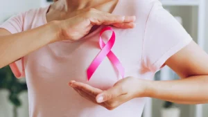 Oncotype DX